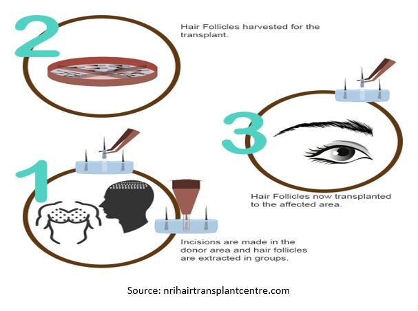 eyelashprocedure eyelashprocedure