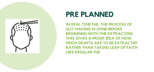 Pre Planning in Real-time FUE