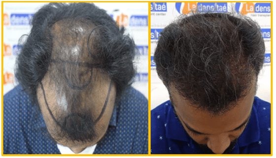 case-kerala-1