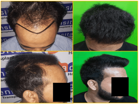 Case of Mr. Aniket