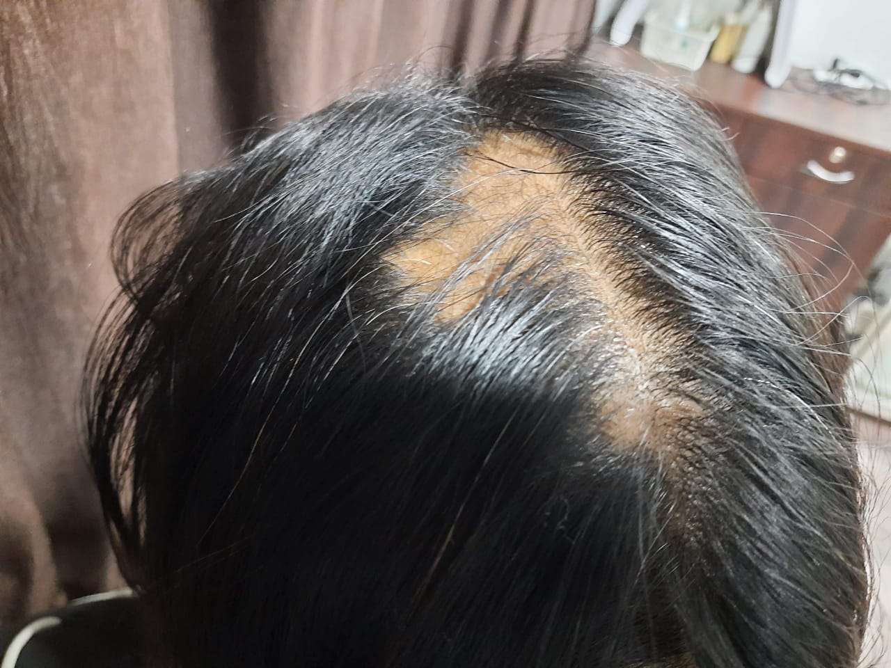 Patient ladensitae before and after success result 5