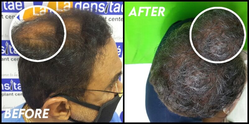 Patient ladensitae before and after success result 6