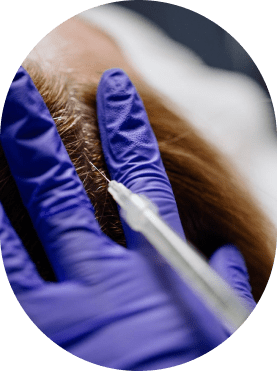 Skin Rejunuvation Treatment