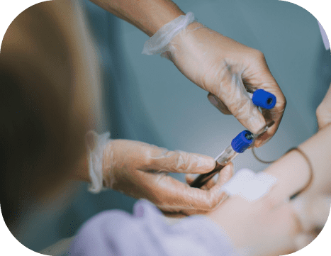 Skin Rejunuvation